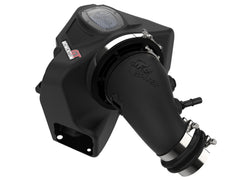 Advanced FLOW Engineering Momentum GT Cold Air Intake System w/Pro 5R Media 54-72103